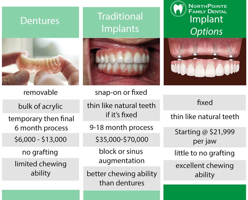 Dental Implant Dentist Grand Rapids