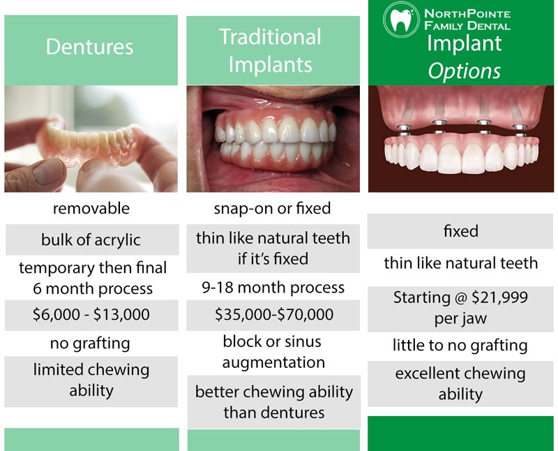 Affordable Dental Implants Restoring Smiles Without Breaking the Bank