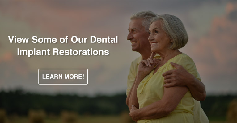 Dental Implant Restoration Dentists Near Me